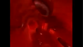 دستگاه گردش خون. رگهای بدن.رابطه بین قلب و ریه. اکسیژن رسانی.  زیست دهم.