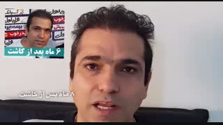 گفت و گو با یکی از متقاضیان کاشت مو در مرکز ایران کاشت