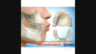 ارتودنسی قبل و بعد