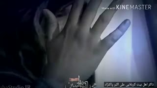 مداح اهل بیت کربلایی علی اکبر پاک نژاد ترمیم سوختگی