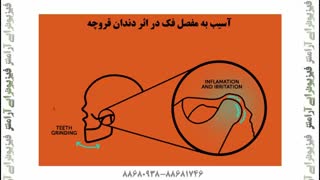 درمان درد مفصل فک نوازندگان سازهای بادی در فیزیوتراپی آرامش