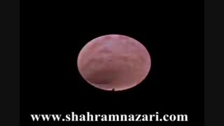 کلدوکوسکوپی در بررسی لاپاروسکوپیک سنگ مجرای صفرا