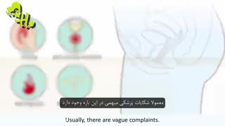 عفونت واژن زنان(بیماری قارچی)