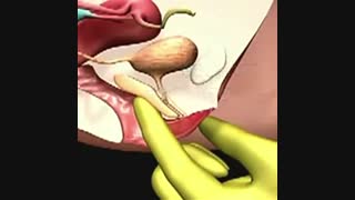 کلیپ نشان دادن جایگاه #نقطه_جی در واژن