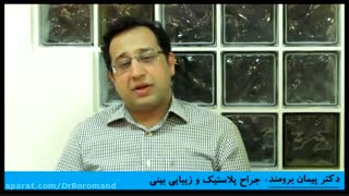 دلایل خونریزی مختصر پس از عمل بینی در برخی افراد