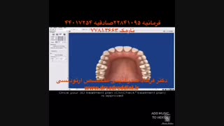 ارتودنسی نامرئی | دکتر فرهاد صدرالدینی بررسی لک صورت