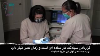 فیشور سیلانت | سیمادنت