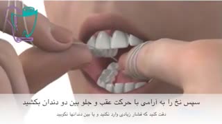 روش صحیح نخ دندان کشیدن | سیمادنت