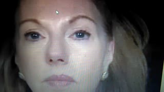 تزریق دیسپورت در تمام صورت (پنج دقیقه اول ) دکتر مقیمی