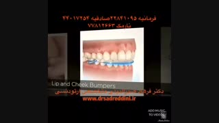 انواع ارتودنسی متحرک | دکتر فرهاد صدرالدینی جرمگیری