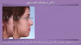 نمونه ارتودنسی انجام شده توسط دکتر همت پور