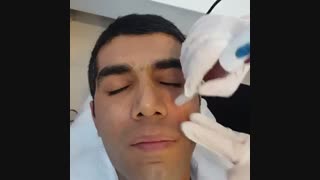 کلیپاستفاده از دستگاه دکتر پن