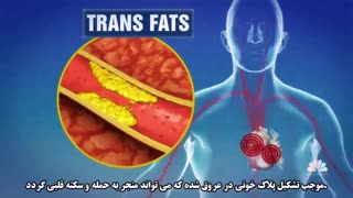 وسوسه چربی های ترانس
