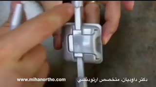 تفاوت ارتودنسی دیمون و ارتودنسی معمولی | دکتر مسعود داوودیان