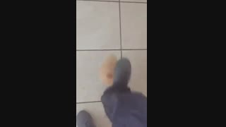 انواع پروتز سینه و وجه تمایز آنها با هم