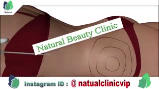 لیپوماتیک چگونه است - نچرال بیوتی