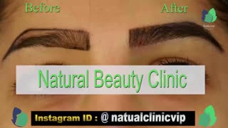 نمونه کار کاشت ابرو- قبل و بعد از کاشت!- نچرال بیوتی