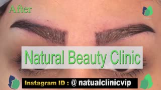 نمونه کار کاشت ابرو- قبل و بعد از کاشت!- نچرال بیوتی