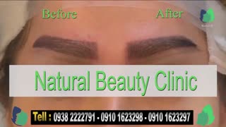 نمونه کار کاشت ابرو- قبل و بعد از کاشت !!!- نچرال بیوتی