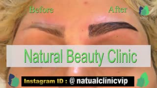 نمونه کار کاشت ابرو- قبل و بعد از کاشت !!!- نچرال بیوتی