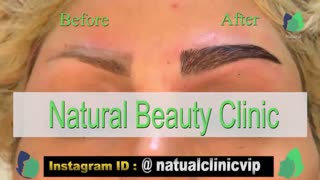 نمونه کار کاشت ابرو- قبل و بعد از کاشت !!!- نچرال بیوتی