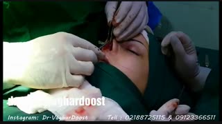 فیلم عمل زیبایی بینی (دکتر رضا وقردوست)( پارت6)