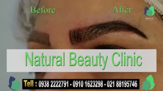 نمونه کار کاشت ابرو- قبل و بعد از کاشت !!!- نچرال بیوتی