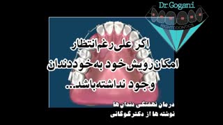 مراحل ارتودنسی - مراحل درمان دندان نهفته (نیش و ...)