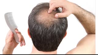 چرخه رشد مو