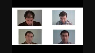 نتایج مناسب در کاشت موی  طبیعی