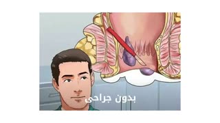 درمان میشه بدون جراحی www.castelinagold.com