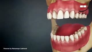 کلینیک تخصصی مهر زعفرانیه - لمینت سرامیکی