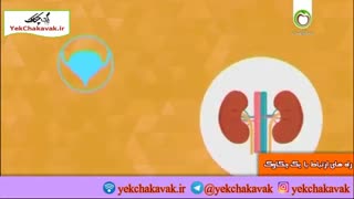برگشت یا ریفلاکس ادراری در کودکان