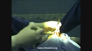 فیلم واقعی عمل بینی - فیلم واقعی جراحی بینی - دکتر مجید کاظمی