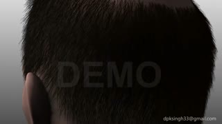 انیمیشن کاشت مو | کلیپ کاشت مو | فیلم کاشت مو