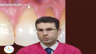 بیماری های لثه قسمت دوم