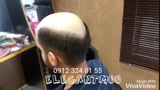 ترمیم موی الگانت02188962259