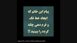 فرم دهی چانه کاشت ابرو