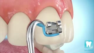 ارتودنسی دندان | کلینیک دندانپزشکی تاج