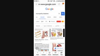 نوروپاتی در دیابت .درد دست و پا و اسهال و استفراغ و ...www.academicresearchco.com   دکتر مقیمی