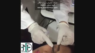 کربوکسی تراپی