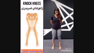 ورزشهای زانوضربدری 09122655648 دکتر متخصص فیزیوتراپی و کایروپراکتیک