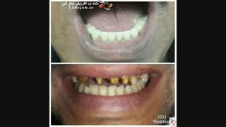 کلینیک دندانسازی زنگنه در کرمانشاه