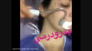 میکرودرم ابریژن درمان جای جوش