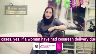 روش های زایمان