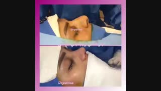 عمل زیبایی بینی (نمونه کار) کلینیک دندانپزشکی