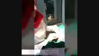 درمان جای جوش با سابسیژن پریودنتیکس