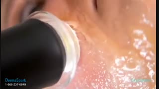 دستگاه جوانسازی پوست 3 کاره پلاژن pollogen