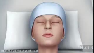 جراحی زیبایی بینی