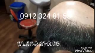 ترمیم مو/ چسب ها و پروتز های ترمیم مو02188962259